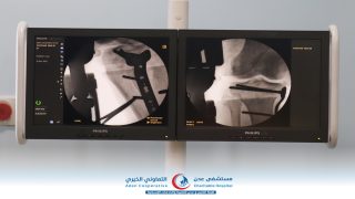 الدكتور ياسر حلبوب يجري أول عملية جراحية في مستشفى عدن التعاوني الخيري