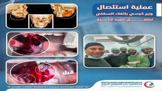 نجاح عملية جراحية كبرى لإزالة ورم كيسي من فك طفل